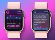 Apple Health VP explains why sleeping with Apple Watch will deliver the most accurate Vitals